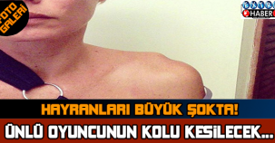 ÜNLÜ OYUNCUNUN KOLU KESİLİYOR..!