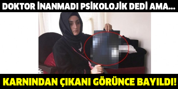 DOKTOR İNANMADI PSİKOLOJİK DEDİ AMA...  KARNINDAN ÇIKANI GÖRÜNCE BAYILDI!