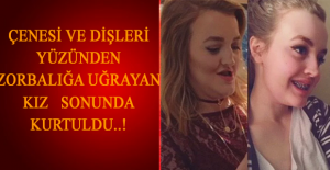 Çenesi ve Dişlerinin Görünümü Nedeniyle Hayatı Boyunca Zorbalığa Maruz Kalıp Ameliyat Olan Kadın