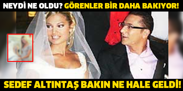 NEYDİ NE OLDU? GÖRENLER BİR DAHA BAKIYOR!  SEDEF ALTINTAŞ BAKIN NE HALE GELDİ!
