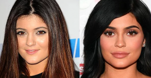 Eski Haline mi Dönüyor? Kylie Jenner Dudak Dolgusunu Çıkarttırdı, Yeni Görüntüsüyle Herkesi Şok Etti!