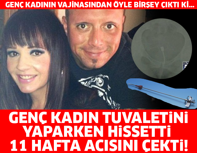 GENÇ KADIN TUVALETİNİ YAPARKEN HİSSETTİ, 11 HAFTA ACISINI ÇEKTİ!