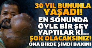 TAM 30 YIL BUNUNLA YAŞADI! EN SONUNDA ÖYLE BİR ŞEY YAPTILAR Kİ... ONA BİRDE ŞİMDİ BAKIN! ŞOK OLACAKSINIZ!