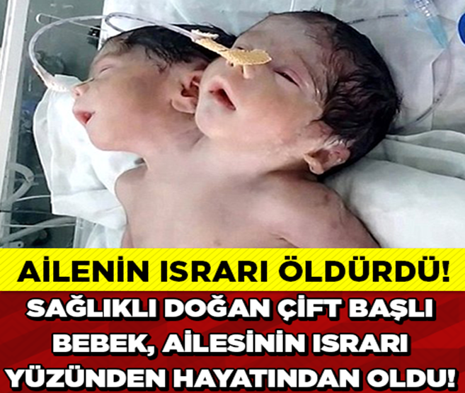 İKİ BAŞLI BEBEK AİLESİNİN ISRARI YÜZÜNDEN ÖLDÜ!