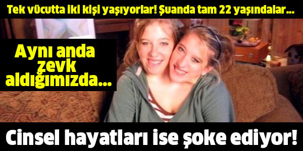 Tek vücutta iki kişi yaşıyorlar! Şuanda tam 22 yaşındalar...  Aynı anda  zevk  aldığımızda... Cinsel hayatları ise şoke ediyor!