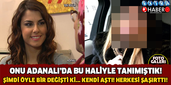 Onu Adanalıda Bu Haliyle Tanımıştık.. Şimdi Öyle Bir Değişti ki !!