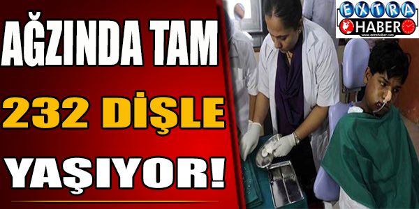 Ağzında Tam 232 Dişle Yaşıyor! En Garip Hastalıklar..