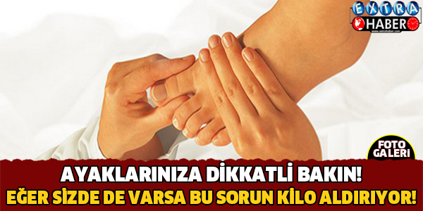 Ayaklarınıza Dikkatli Bakın! Bu Hastalık Kilo Aldırıyor..