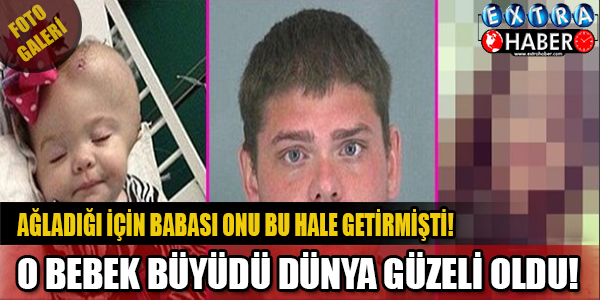 BABASI SAKAT BIRAKTI!