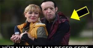 YÜZ NAKLİ OLAN ADAM BABA OLDU!! FAKAT BEBEĞİ ÇOK...