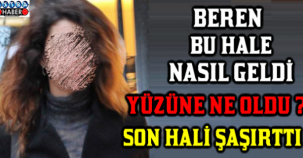 BEREN SAAT BU HALE NASIL GELDİ !