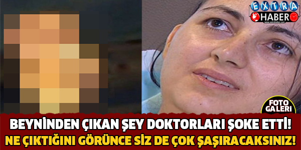 Beyninden Çıkan Şey Doktorları Şoke Etti!