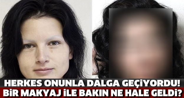Herkes Onunla Dalga Geçiyordu! Makyajla Bakın Ne Hale Geldi?