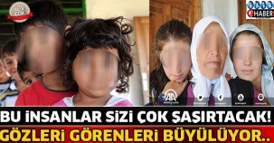 Bu İnsanların Gözleri Herkesi Büyülüyor ! Görünce Şoke Olacaksınız...