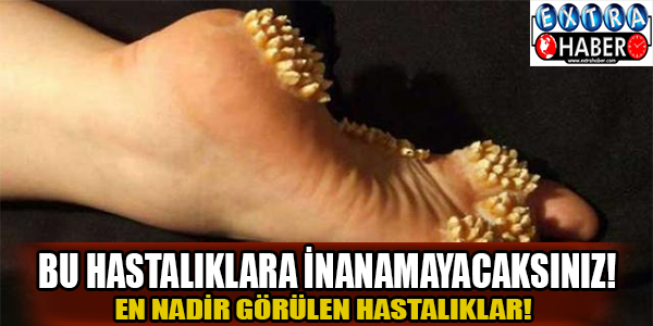 Bu hastalıklara inanamayacaksınız!
