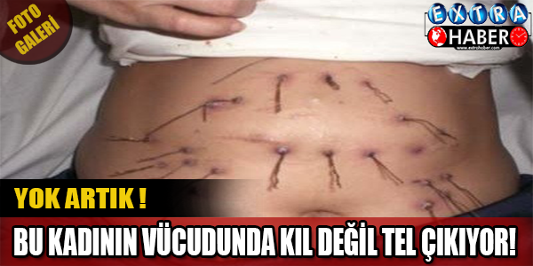 Böyle Bir Hastalık Yok