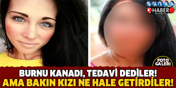 ASLINI ÖĞRENENLER ŞOK OLUYOR ! BURNU KANADI, ALERJİ DEDİLER, TEDAVİ EDİYORUZ DERKEN KIZI ÖYLE BİR HALE GETİRDİLER Kİ...