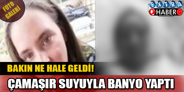 ÇAMAŞIR SUYUYLA BANYO YAPTI! BAKIN NE HALE GELDİ...
