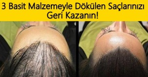 DÖKÜLEN SAÇLARI GERİ KAZANDIRAN SİHİRLİ FORMÜL.!