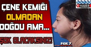 Çene kemiği olmadan doğdu ama...