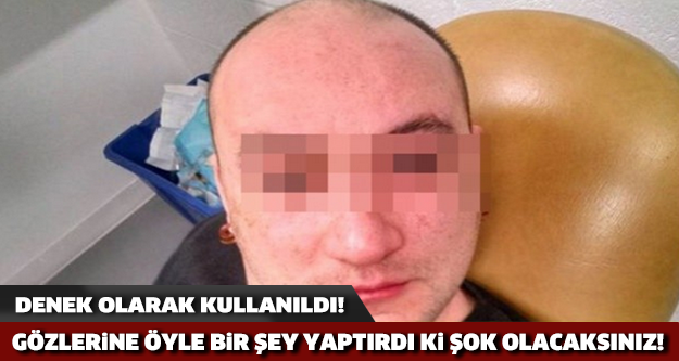 GÖZLERİNE ÖYLE BİR ŞEY YAPTIRDI Kİ ŞOK OLACAKSINIZ!