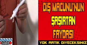 Diş macununun şaşırtan faydası! Yok artık diyeceksiniz..!