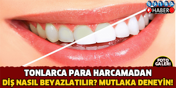 TONLARCA PARA HARCAMADAN DİŞ NASIL BEYAZLATILIR?