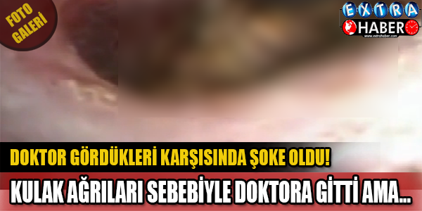 Hastanın Kulağındaki Ağrılarının Sebebini Araştıran Doktor Bile Şok Oldu...Kulağa Detaylı Bir Şekilde Bakan Doktor Gördükleri Karşısında...