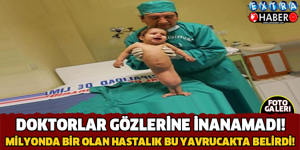DOKTORLAR GÖZLERİNE İNANAMADI! MİLYONDA BİR GÖRÜLEN RAHATSIZLIK BU YAVRUCAKTA GÖRÜLDÜ! SUBHANALLAH...