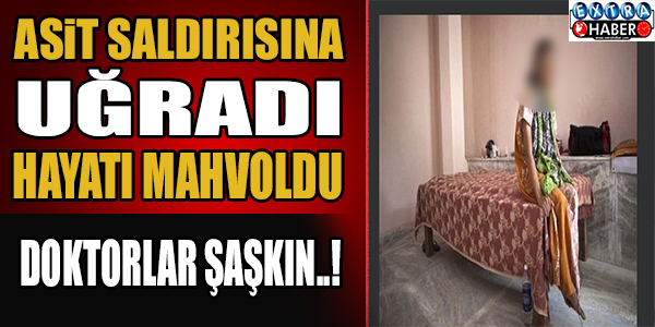 ASİT SALDIRISINA UĞRADI HAYATI MAHVOLDU !