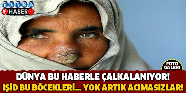 Sonunda Bunu da Yaptılar! Bu Böcek İnsan Eti Yiyor..