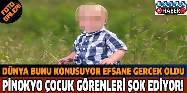 Dünya bunu konuşuyor efsane gerçek oldu! Pinokyo çocuk görenleri şok oluyor!!!