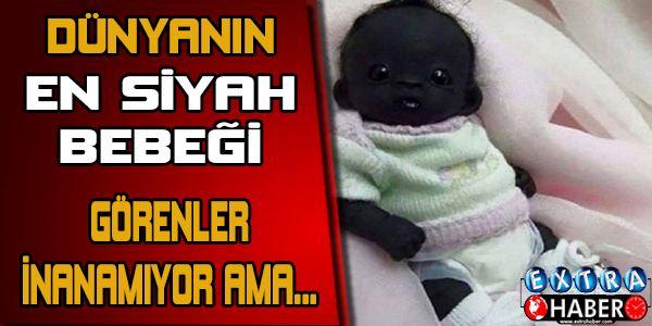 Sosyal medyayı sallayan bebek!