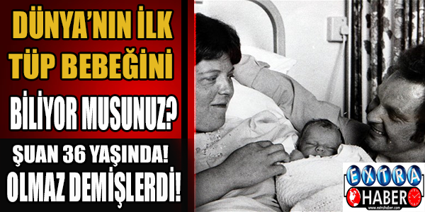 Dünya'nın ilk tüp bebeğini biliyor muydunuz?