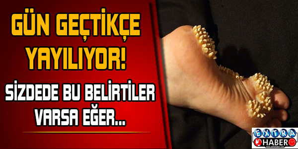 Eğer bu belirtiler varsa dikkat edin..!