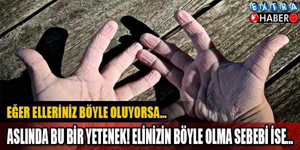 EĞER ELLERİNİZ BÖYLE OLUYORSA.. ASLINDA BU BİR YETENEK! ELiNİZİN BÖYLE OLMASININ NEDENİ..