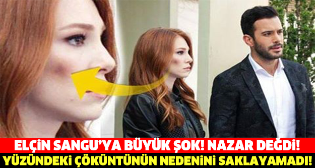 Kiralık Aşk'ın yıldızından kötü haber!