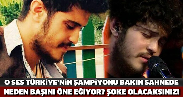 Meğer başını öne eğmesinin bir sebebi varmış!