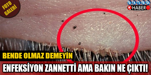 GÖZÜNÜZE DİKKAT! ENFEKSİYON ZANNETTİ BAKIN NE ÇIKTI! BU KADARIDA OLMAZ DEMEYİN...