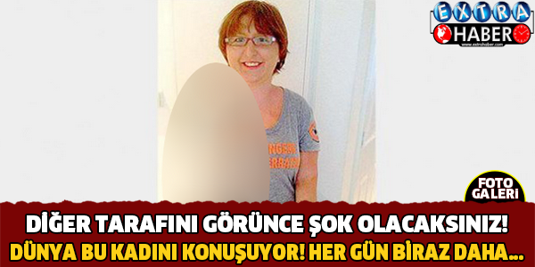 Diğer Tarafını Görünce Şok Olacaksınız ! Dünya Bu Kadını Konuşuyor.. Hergün Biraz Daha....