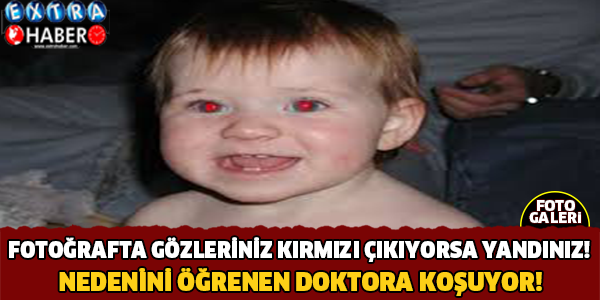 Fotoğraflarda gözleriniz böyle çıkıyorsa yandınız! Gözlerinizin böyle çıkmasının nedeni..