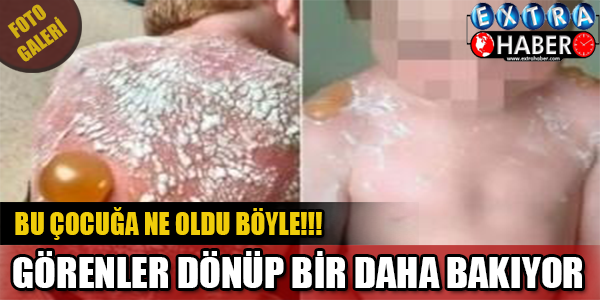 DİKKAT SİZİNDE BAŞINIZA GELEBİLİR!! BU ÇOCUĞA NE OLDU BÖYLE GÖRENLER DÖNÜP BİR DAHA BAKIYOR!
