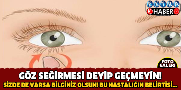 Göz Seğirmesi Deyip Geçmeyin.. O Hastalığın Belirtisi!