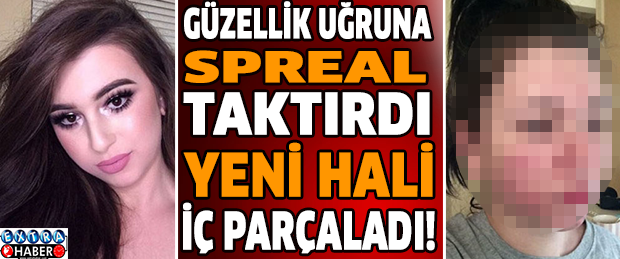 Güzellik uğruna spreal taktırdı yeni hali iç parçaladı!