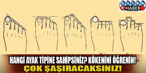 Hangi ayak tipine sahipsiniz?