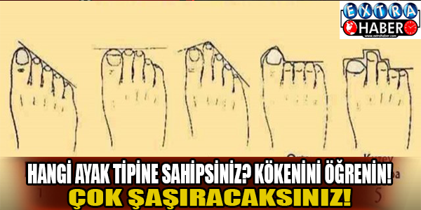 Hangi ayak tipine sahipsiniz?