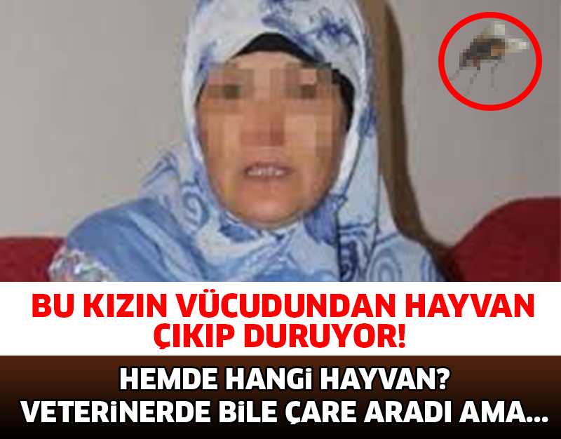 BU KADININ VÜCUDUNDAN ÖYLE BİR HAYVAN ÇIKIYOR Kİ... ŞOK OLACAKSINIZ..!