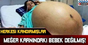 Herkesi kandırmışlar! Meğer karnındaki bebek değilmiş...