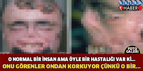 Öyle Bir Hastalığı Var ki...