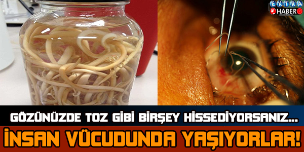 İNSAN VÜCUDUNDA YAŞAYAN PARAZİTLER